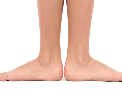 Flat Feet